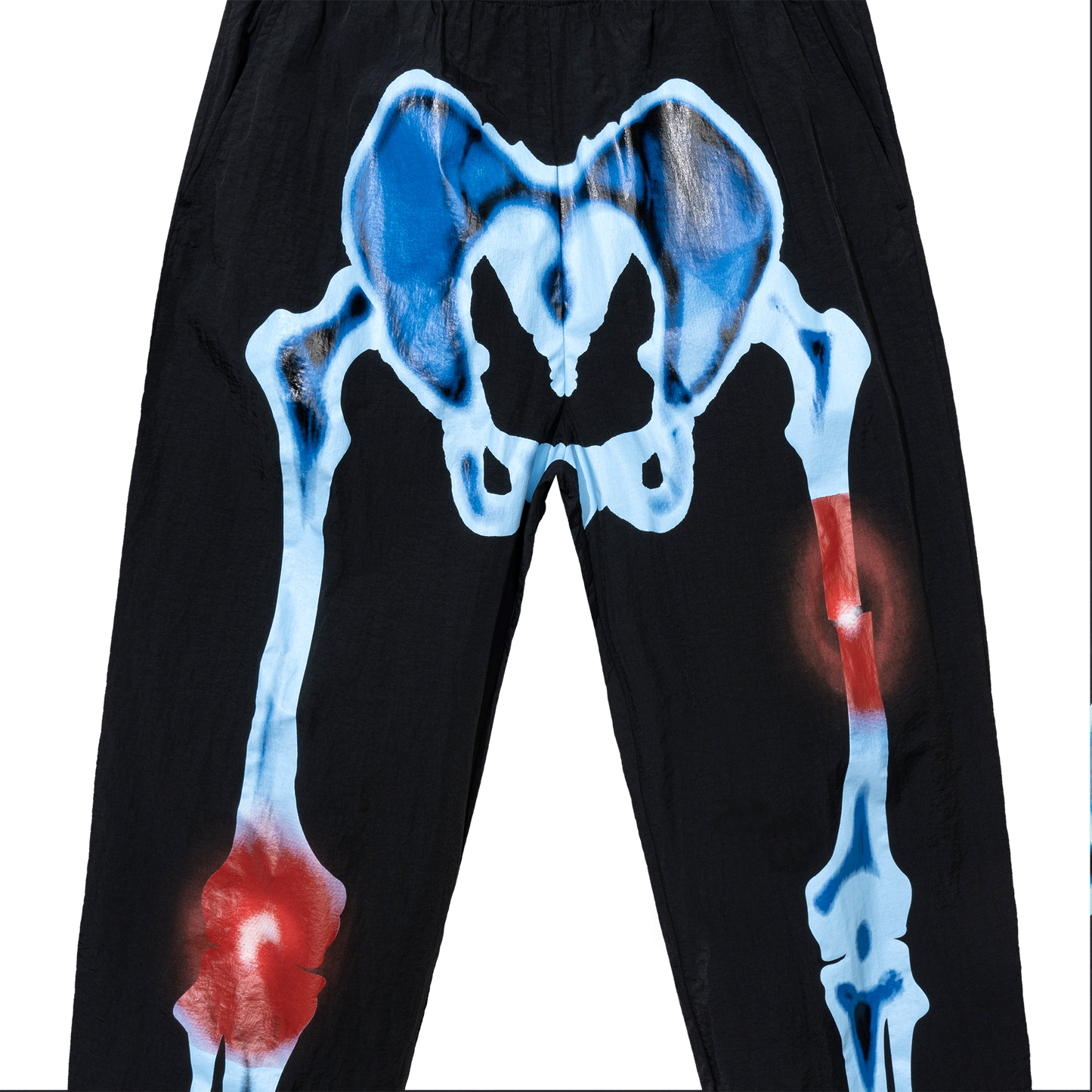INJURIES TRACK PANTS
