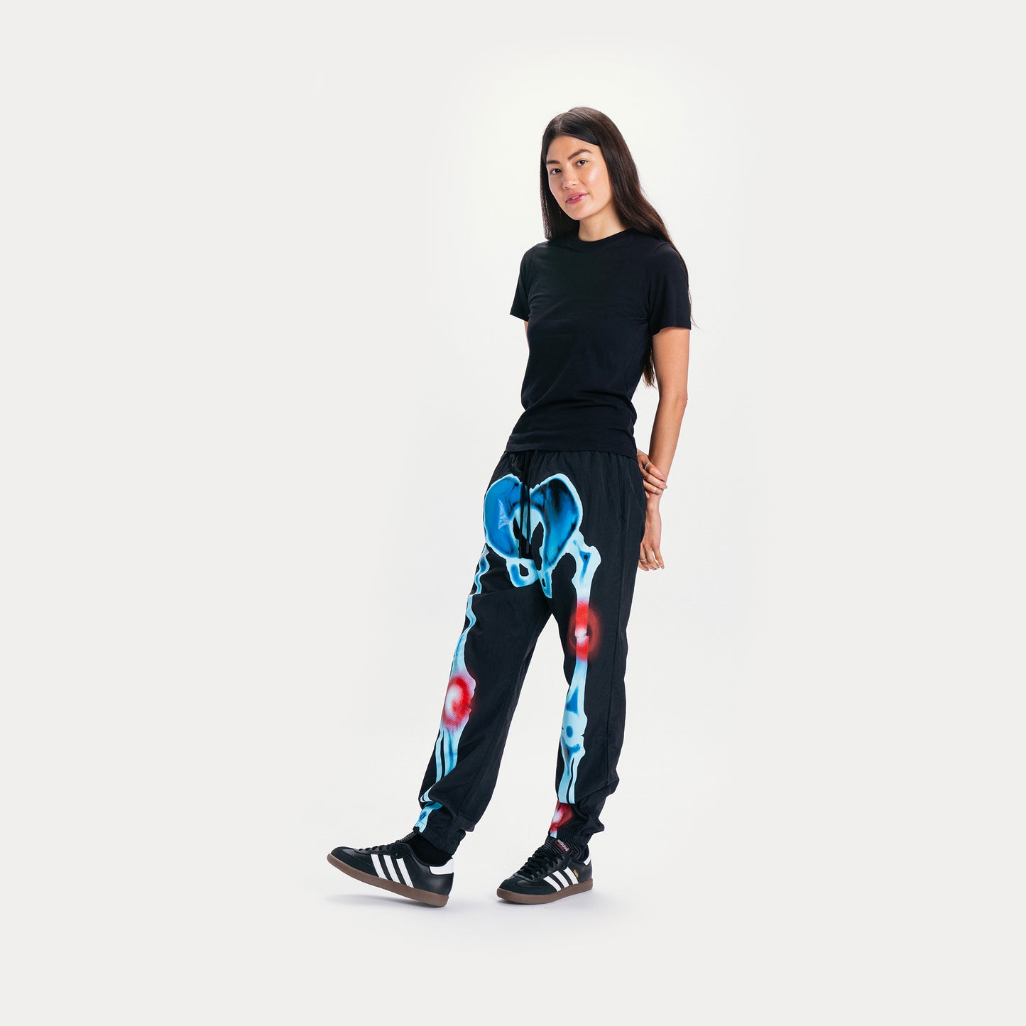 INJURIES TRACK PANTS